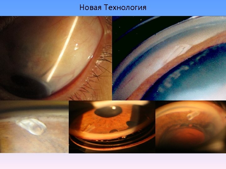 Новая Технология 