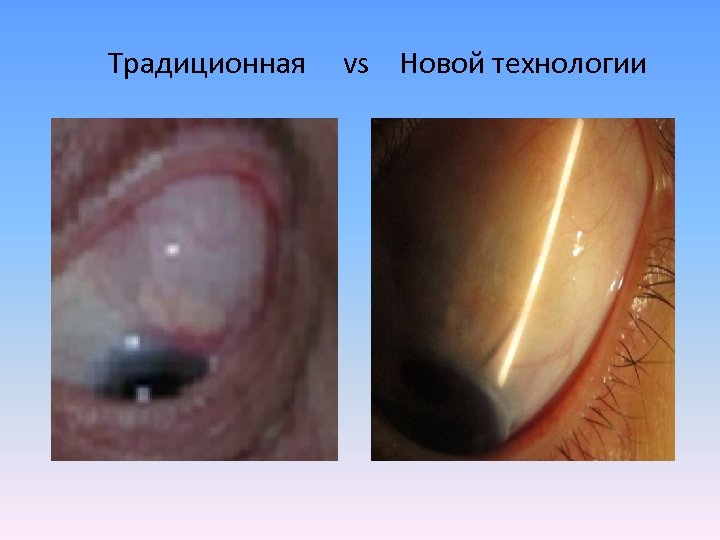 Традиционная vs Новой технологии 