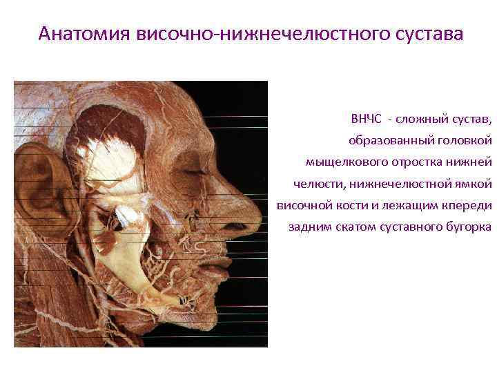 Анатомия височно-нижнечелюстного сустава ВНЧС - сложный сустав, образованный головкой мыщелкового отростка нижней челюсти, нижнечелюстной