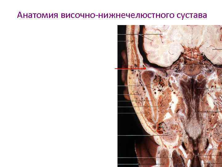 Анатомия внчс презентация