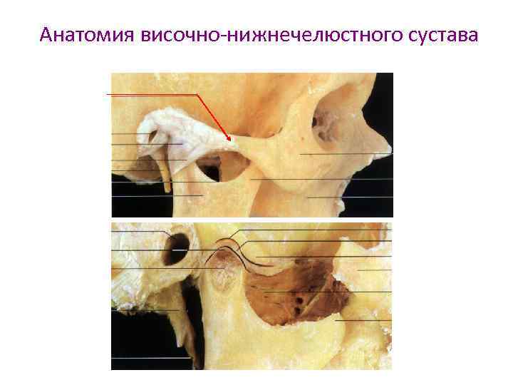 Анатомия височно-нижнечелюстного сустава 