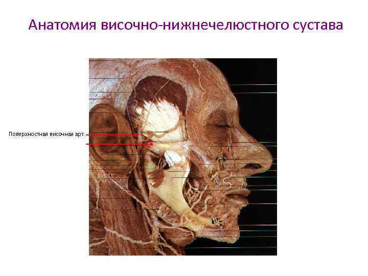 Для диагностики смещения суставного диска височно нижнечелюстного сустава внчс применяют метод