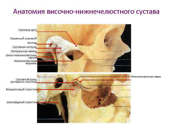 Анатомия височно-нижнечелюстного сустава Скуловая дуга Наружный слуховой проход Суставная капсула Латеральная связка Шило-нижнечелюстная связка