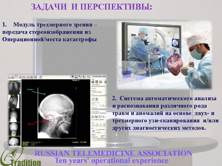 ЗАДАЧИ И ПЕРСПЕКТИВЫ: 1. Модуль трехмерного зрения – передача стереоизображения из Операционной/места катастрофы 2.