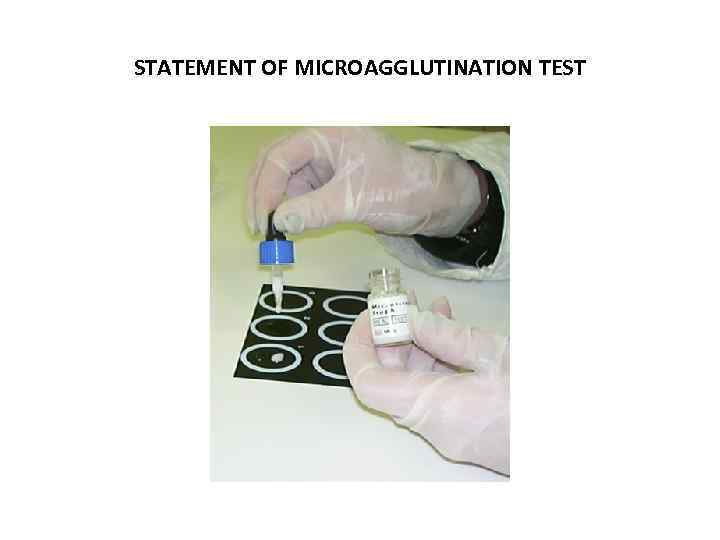 STATEMENT OF MICROAGGLUTINATION TEST 