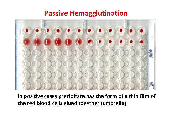 Passive Hemagglutination In positive cases precipitate has the form of a thin film of