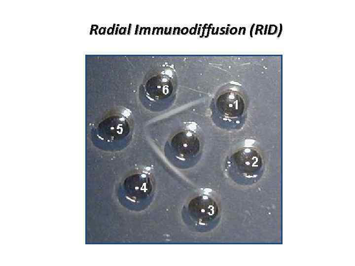 Radial Immunodiffusion (RID) 