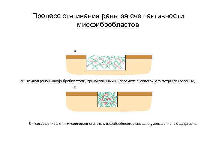 Процесс стягивания раны за счет активности миофибробластов а – кожная рана с миофибробластами, прикрепленными