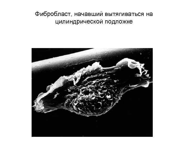 Фибробласт, начавший вытягиваться на цилиндрической подложке 