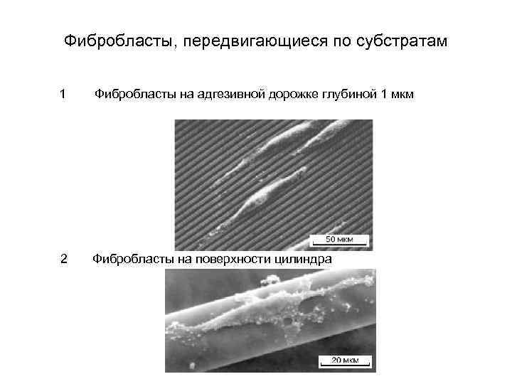 Фибробласты, передвигающиеся по субстратам 1 Фибробласты на адгезивной дорожке глубиной 1 мкм 2 Фибробласты