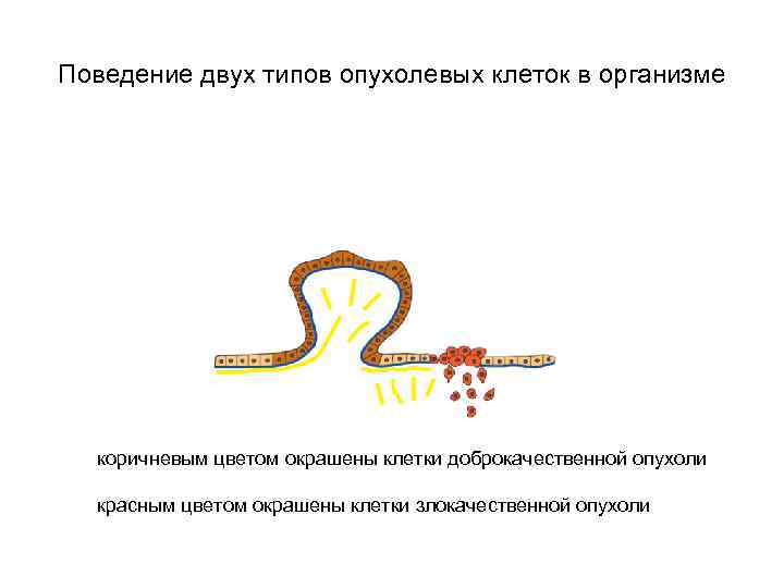 Поведение двух типов опухолевых клеток в организме коричневым цветом окрашены клетки доброкачественной опухоли красным