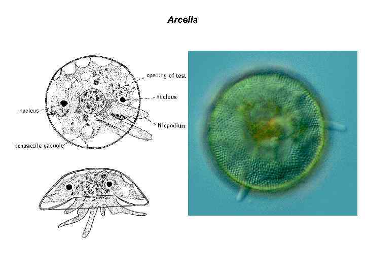 Arcella 