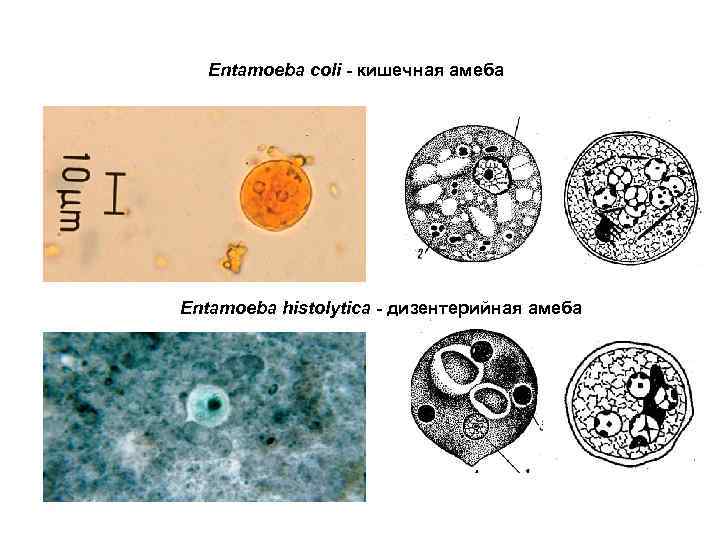 Entamoeba coli - кишечная амеба Entamoeba histolytica - дизентерийная амеба 