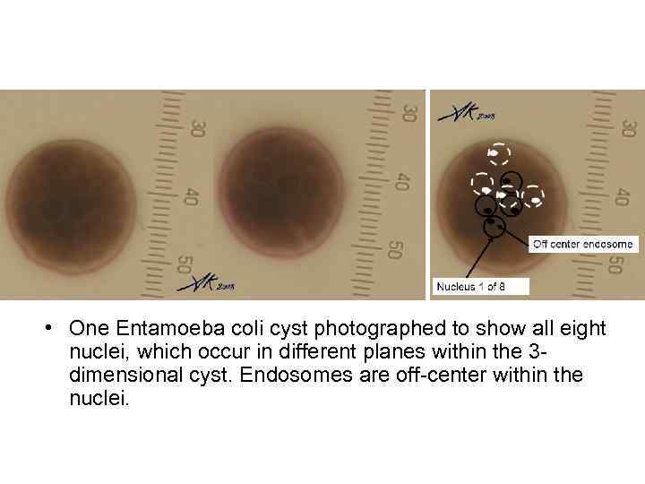  • One Entamoeba coli cyst photographed to show all eight nuclei, which occur