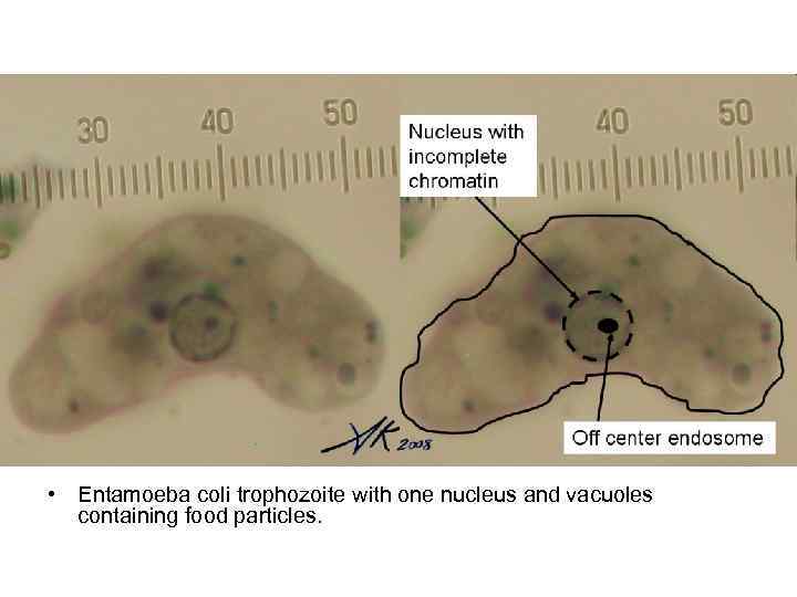  • Entamoeba coli trophozoite with one nucleus and vacuoles containing food particles. 