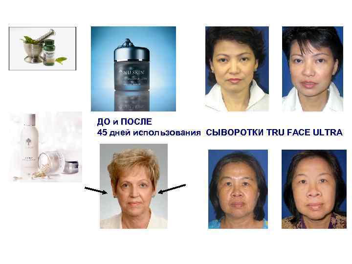 ДО и ПОСЛЕ 45 дней использования СЫВОРОТКИ TRU FACE ULTRA 