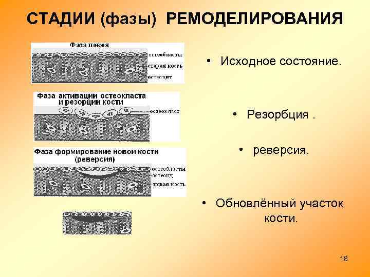 СТАДИИ (фазы) РЕМОДЕЛИРОВАНИЯ • Исходное состояние. • Резорбция. • реверсия. • Обновлённый участок кости.