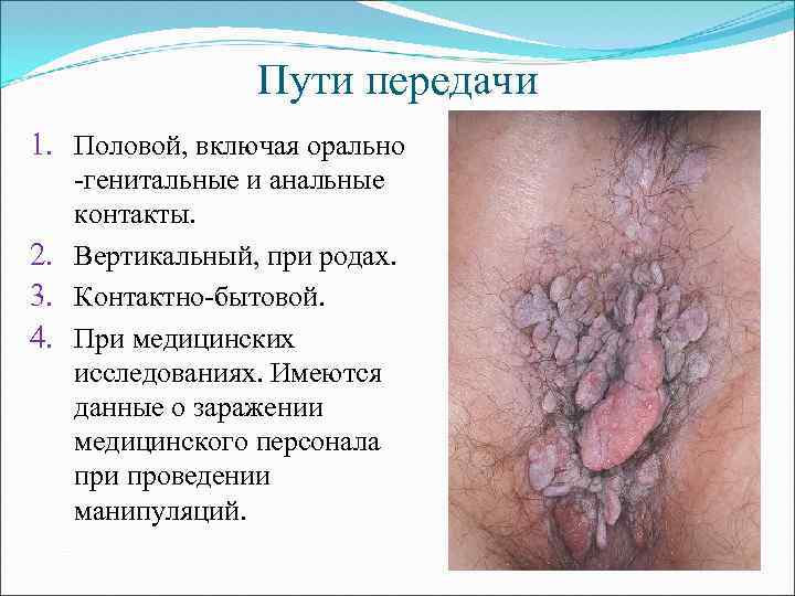 Пути передачи 1. Половой, включая орально -генитальные и анальные контакты. 2. Вертикальный, при родах.