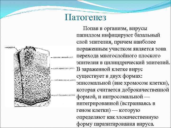 Патогенез Попав в организм, вирусы папиллом инфицируют базальный слой эпителия, причем наиболее пораженным участком