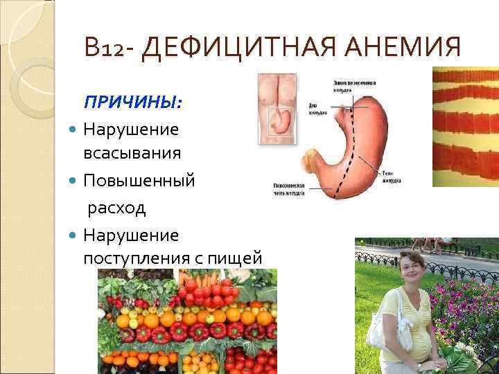 В 12 - ДЕФИЦИТНАЯ АНЕМИЯ ПРИЧИНЫ: Нарушение всасывания Повышенный расход Нарушение поступления с пищей