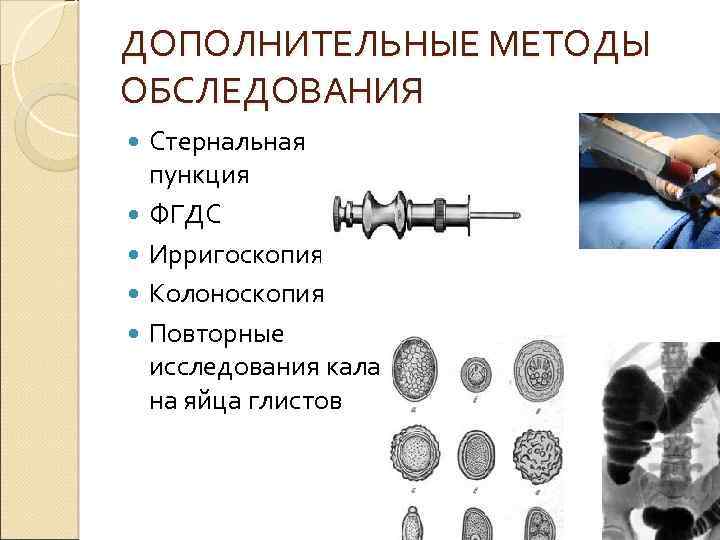 ДОПОЛНИТЕЛЬНЫЕ МЕТОДЫ ОБСЛЕДОВАНИЯ Стернальная пункция ФГДС Ирригоскопия Колоноскопия Повторные исследования кала на яйца глистов