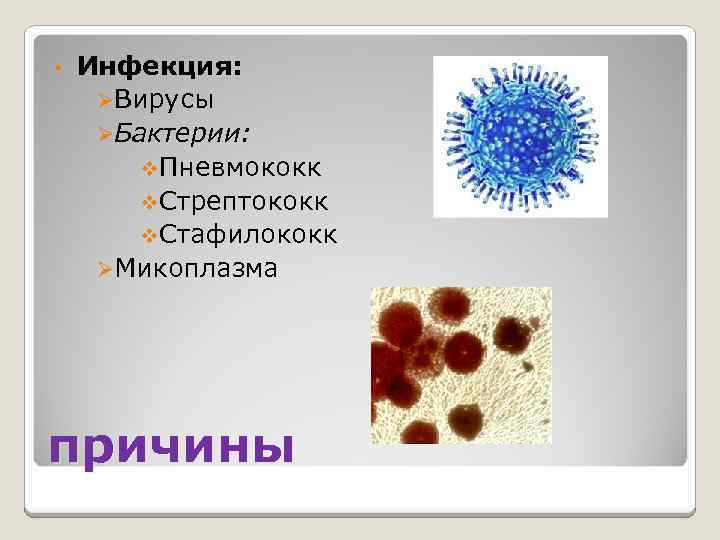  • Инфекция: ØВирусы ØБактерии: v. Пневмококк v. Стрептококк v. Стафилококк ØМикоплазма причины 