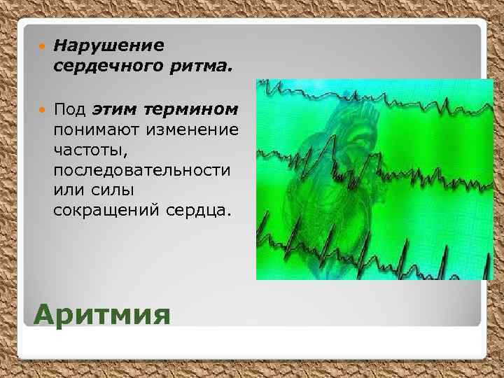  Нарушение сердечного ритма. Под этим термином понимают изменение частоты, последовательности или силы сокращений