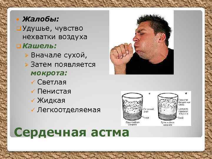 Жалобы: q Удушье, чувство нехватки воздуха q Кашель: Ø Вначале сухой, Ø Затем появляется