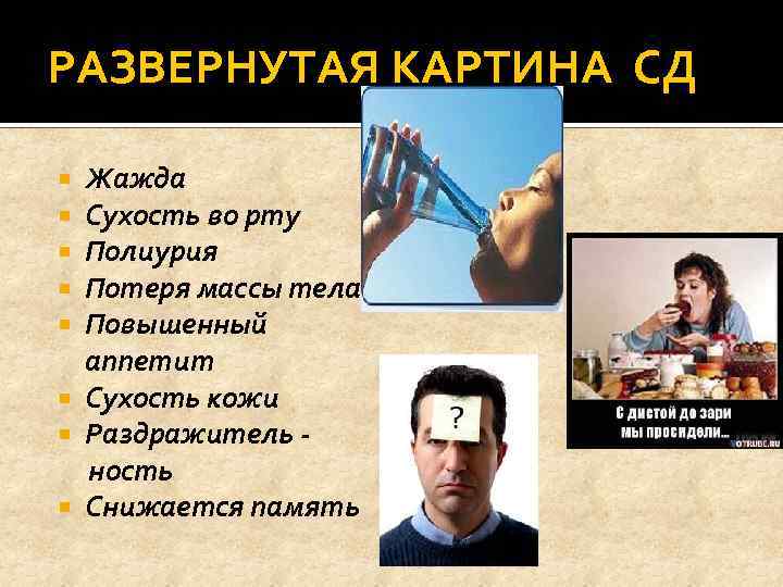 РАЗВЕРНУТАЯ КАРТИНА СД Жажда Сухость во рту Полиурия Потеря массы тела Повышенный аппетит Сухость