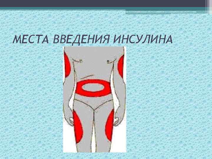 МЕСТА ВВЕДЕНИЯ ИНСУЛИНА 