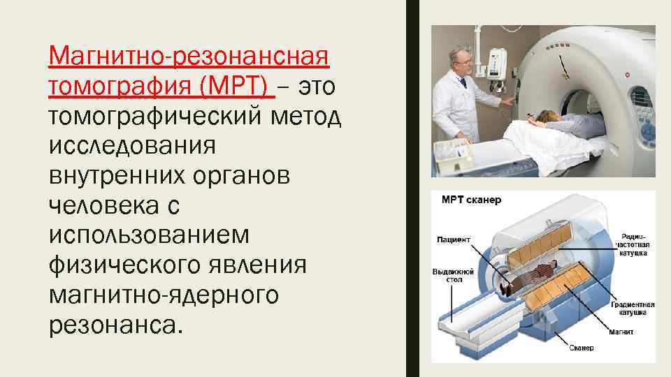 Магнитно-резонансная томография (МРТ) – это томографический метод исследования внутренних органов человека с использованием физического