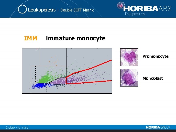 Leukopoïesis - IMM Double DIFF Matrix immature monocyte Promonocyte Monoblast 