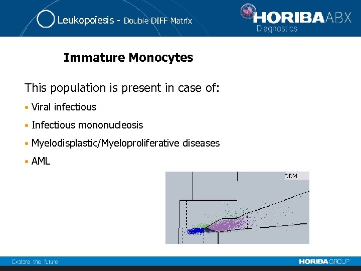 Leukopoïesis - Double DIFF Matrix Immature Monocytes This population is present in case of: