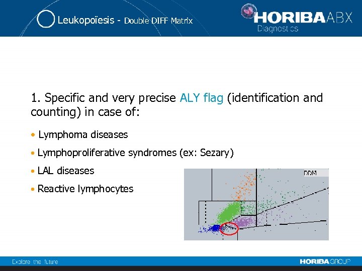 Leukopoïesis - Double DIFF Matrix 1. Specific and very precise ALY flag (identification and