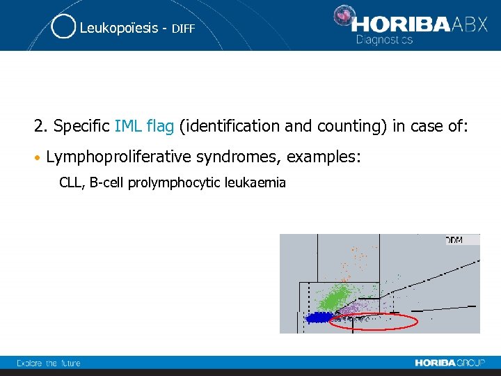 Leukopoïesis - DIFF 2. Specific IML flag (identification and counting) in case of: •