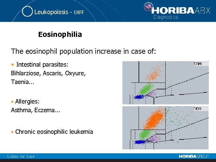 Leukopoïesis - DIFF Eosinophilia The eosinophil population increase in case of: • Intestinal parasites: