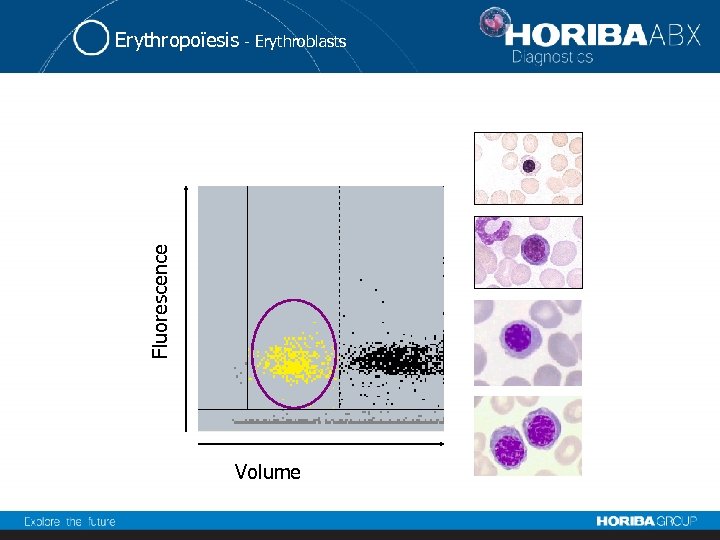 Fluorescence Erythropoïesis - Erythroblasts Volume 