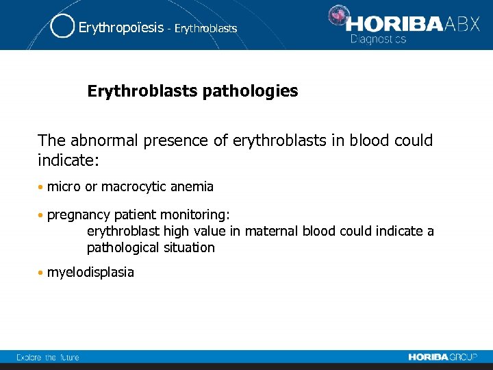 Erythropoïesis - Erythroblasts pathologies The abnormal presence of erythroblasts in blood could indicate: •