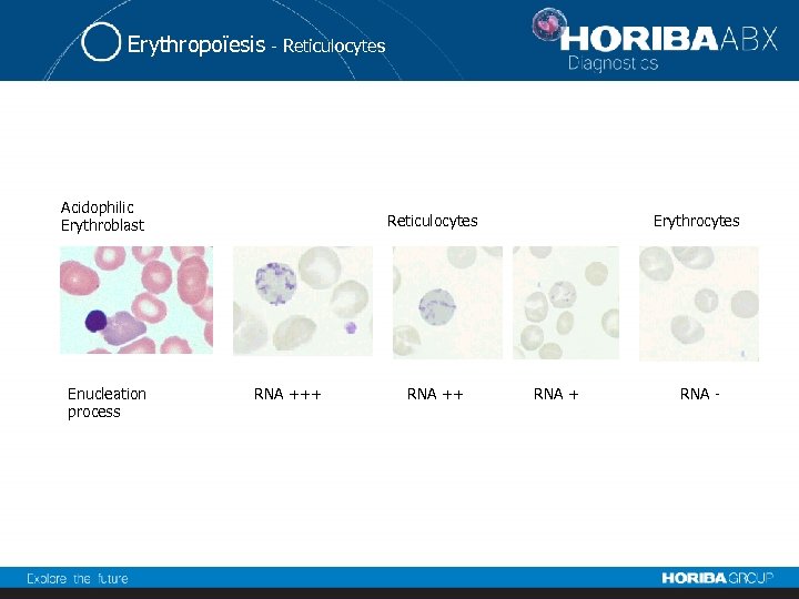 Erythropoïesis - Reticulocytes Acidophilic Erythroblast Enucleation process Reticulocytes RNA +++ RNA ++ Erythrocytes RNA