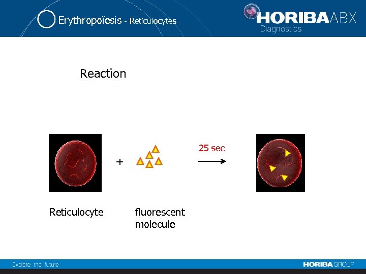 Erythropoïesis - Reticulocytes Reaction 25 sec + Reticulocyte fluorescent molecule 