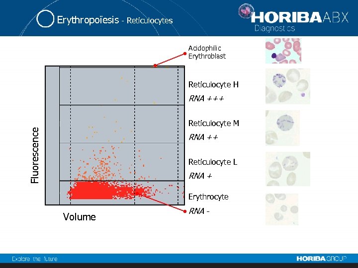 Erythropoïesis - Reticulocytes Acidophilic Erythroblast Reticulocyte H RNA +++ Fluorescence Reticulocyte M RNA ++