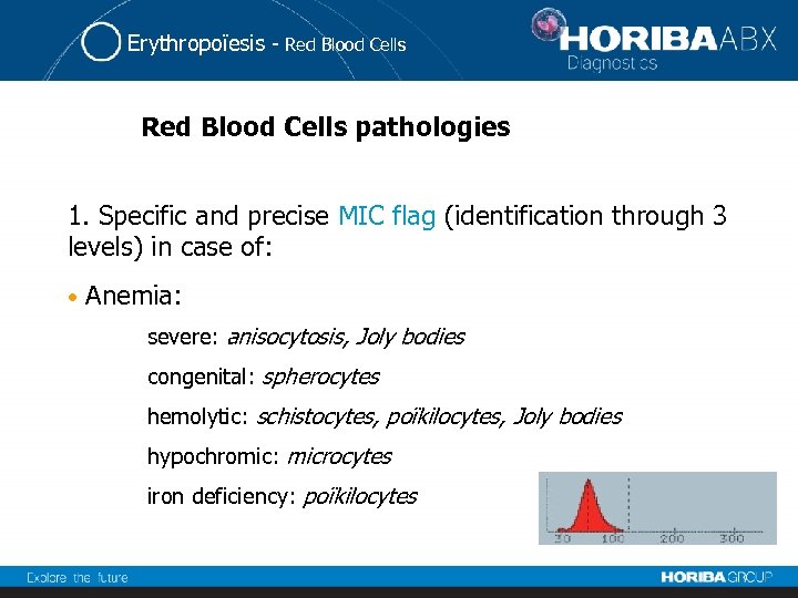 Erythropoïesis - Red Blood Cells pathologies 1. Specific and precise MIC flag (identification through