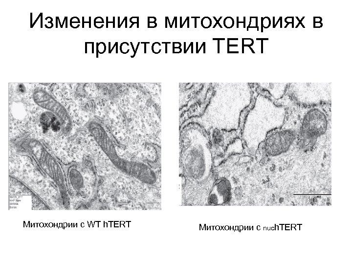 Изменения в митохондриях в присутствии ТЕRT Митохондрии с WT h. TERT Митохондрии с nuch.