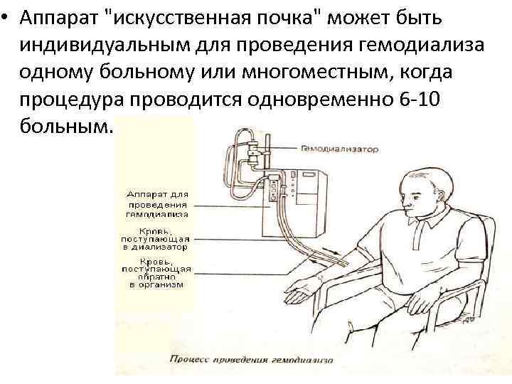  • Аппарат "искусственная почка" может быть индивидуальным для проведения гемодиализа одному больному или