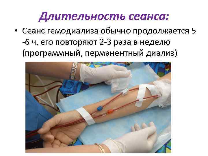 Длительность сеанса: • Сеанс гемодиализа обычно продолжается 5 -6 ч, его повторяют 2 -3