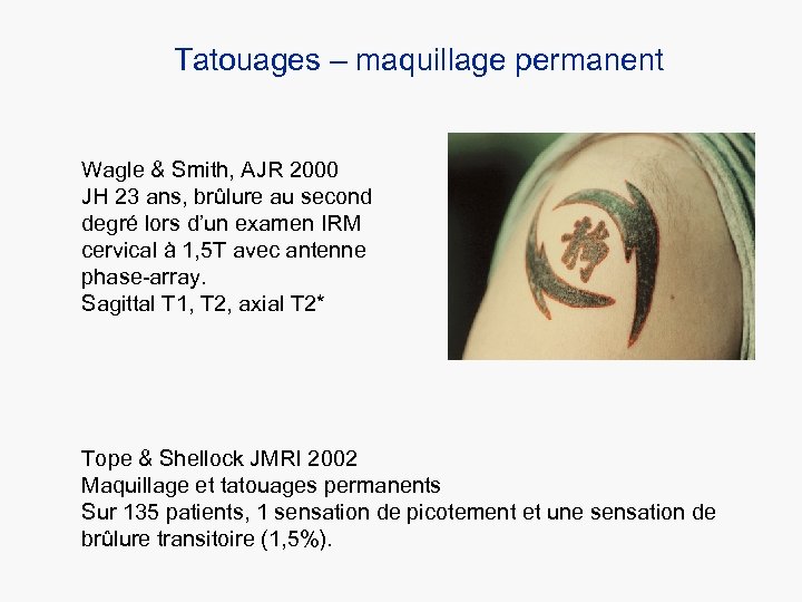 Tatouages – maquillage permanent Wagle & Smith, AJR 2000 JH 23 ans, brûlure au