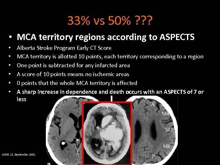 33% vs 50% ? ? ? • MCA territory regions according to ASPECTS •