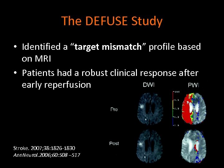 The DEFUSE Study • Identified a “target mismatch” profile based on MRI • Patients