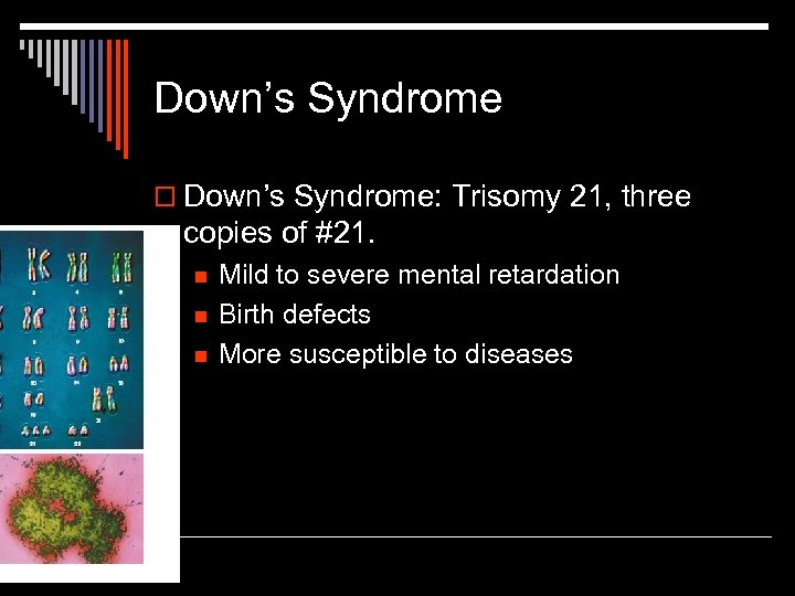 Down’s Syndrome o Down’s Syndrome: Trisomy 21, three copies of #21. n n n