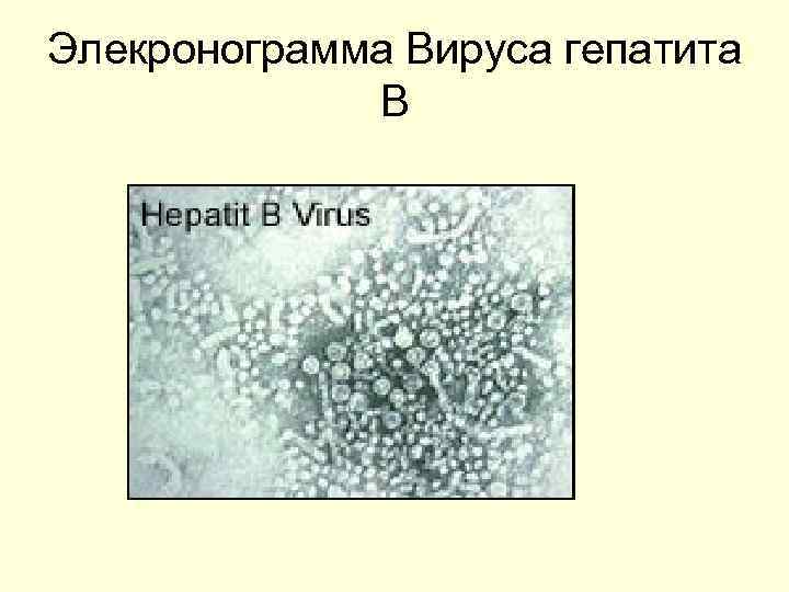 Элекронограмма Вируса гепатита В 